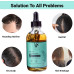 NXUS 118 ml Large Rosemary Oil For Hair Growth with Scalp Massager & Derma Roller (0.25mm) To Stop Hair Fall & Receding Hair Line. Scalp & Hair Strengthening Oil. 100% Organic & Natural. Hair Growth.
