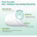 لاصقة SOME BY MI Micro Pin Spot Patch | لاصقة هيدروكولويدية دقيقة الإبر لعلاج البثور تحتوي على حمض الساليسيليك وحمض الهيالورونيك | تغطية البقع التي تركز على العناية بمشاكل البشرة | عبوة من قطعة واحدة، 14 مم، 9 قطع