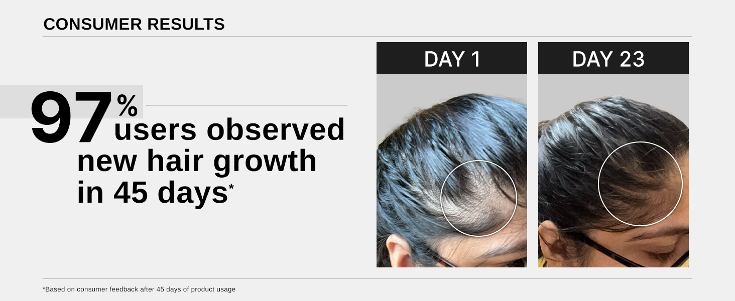 Bare-Anatomy-Advanced-Hair-Growth-Serum-3-Redensyl-4-Anagain