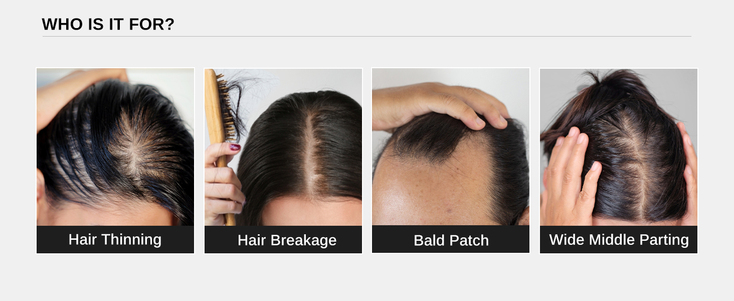 Bare-Anatomy-Advanced-Hair-Growth-Serum-3-Redensyl-4-Anagain