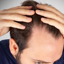 NXUS-118-ml-Large-Rosemary-Oil-For-Hair-Growth-with-Scalp-Ma