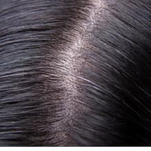NXUS-118-ml-Large-Rosemary-Oil-For-Hair-Growth-with-Scalp-Ma